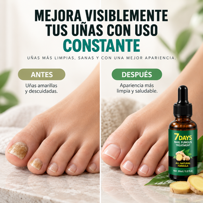NAILVIA™ – Aceite Reparador para Uñas Dañadas y Amarillentas