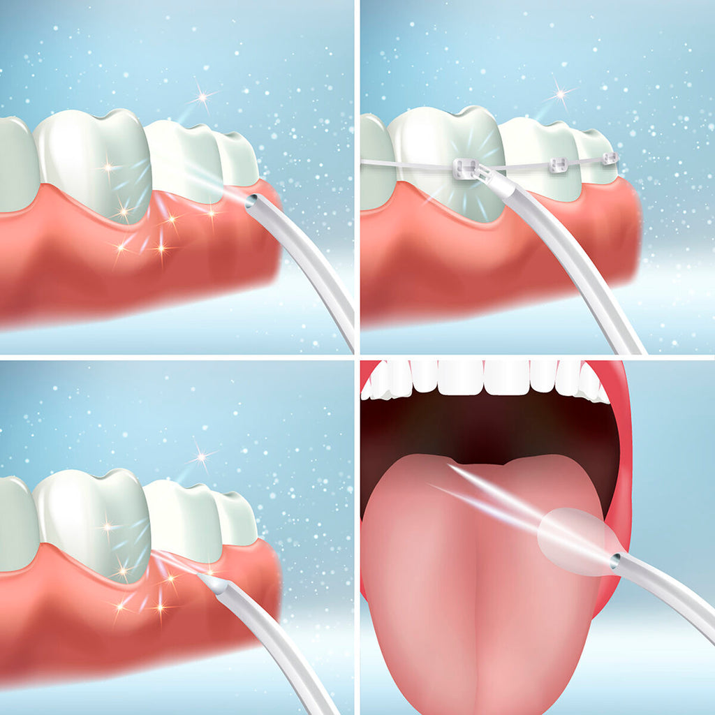 Irrigador Oral Portátil Recargable